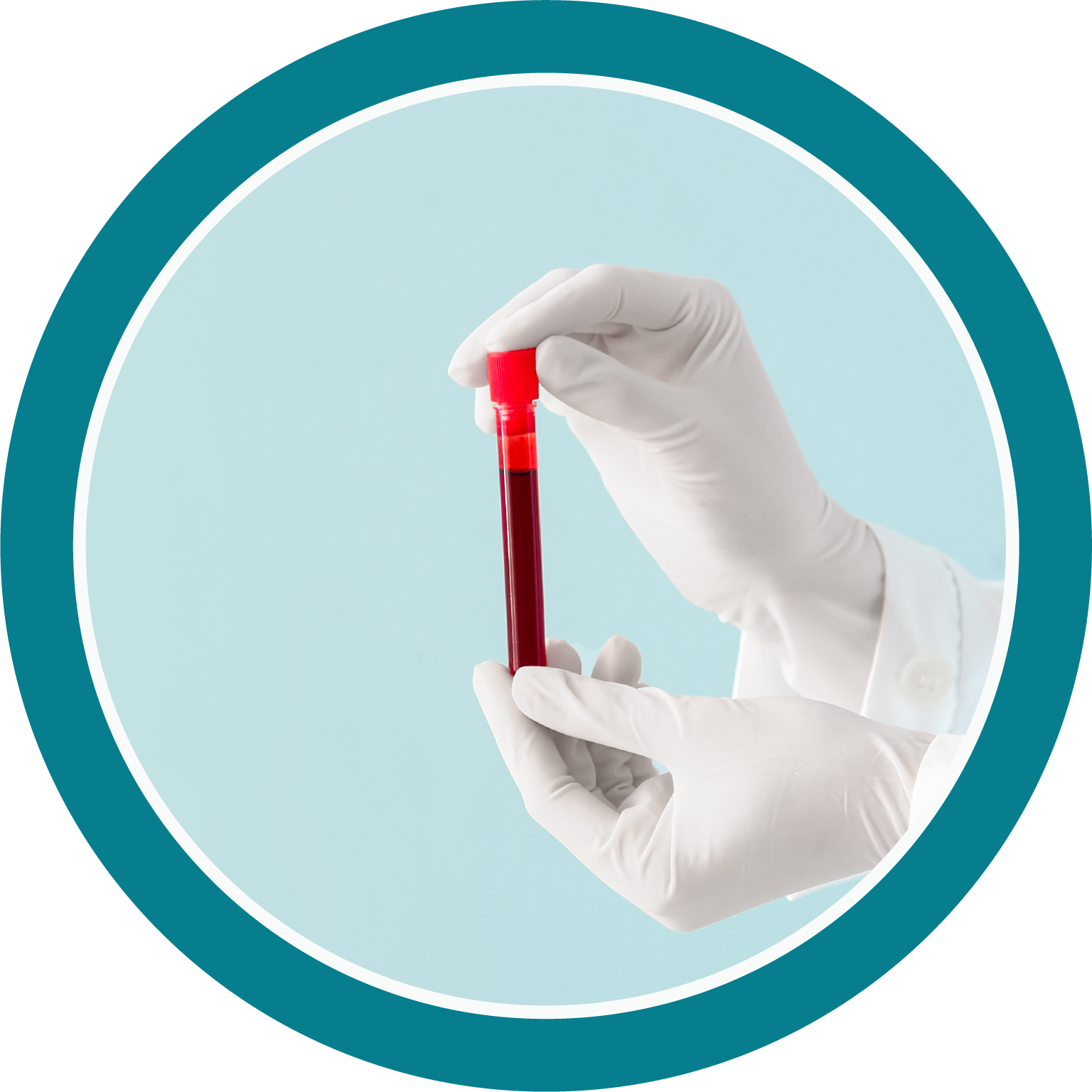 Hands wearing white gloves holding a test tube filled with blood against a light blue background.