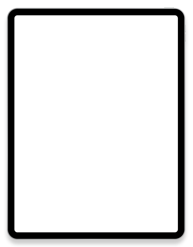 A man balances on a slackline in a park, holding a blue juggling ball in each hand.