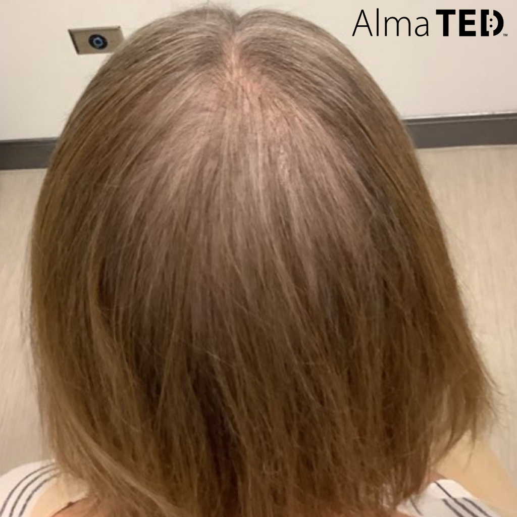 Before and after images