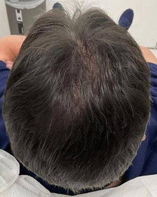 Before and after images