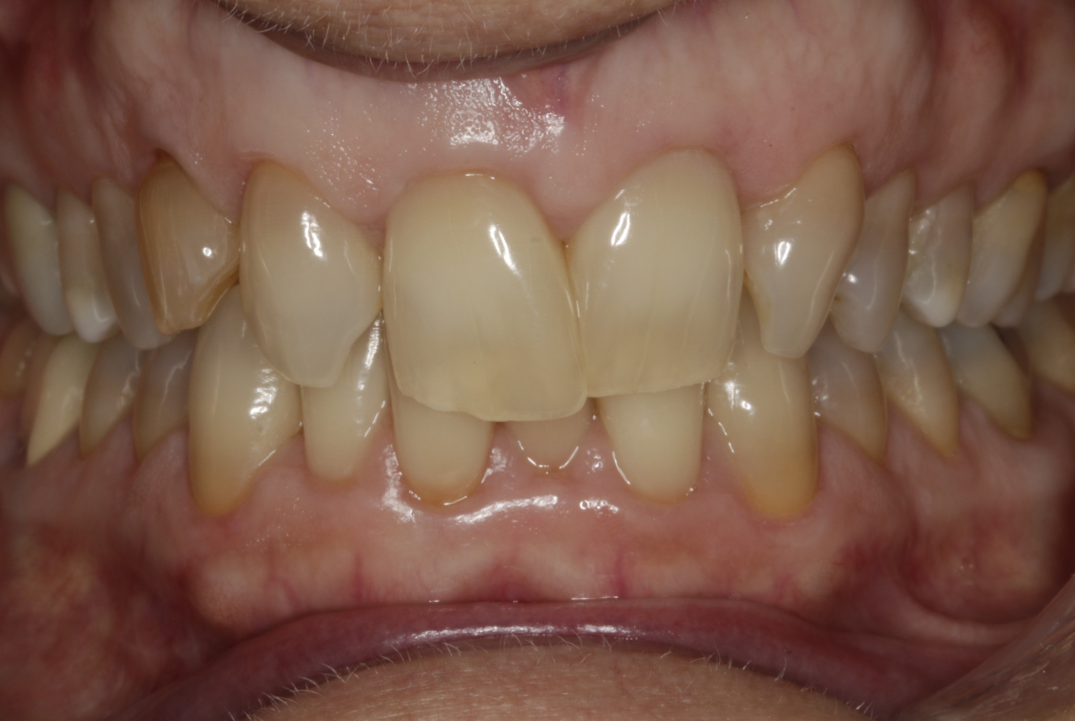 Before Image