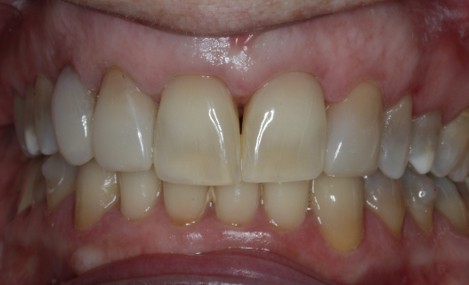 After Image