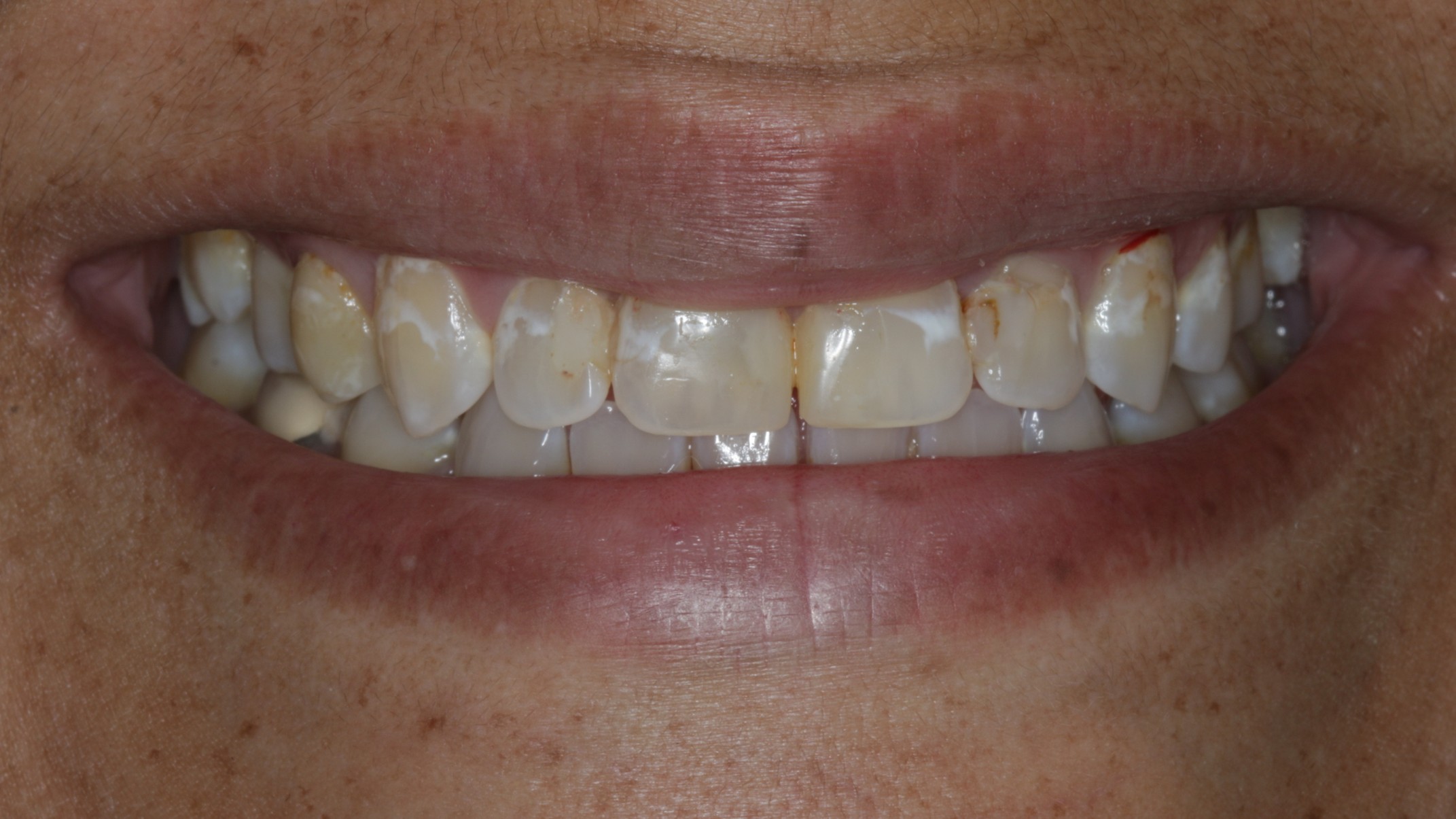 Before Image