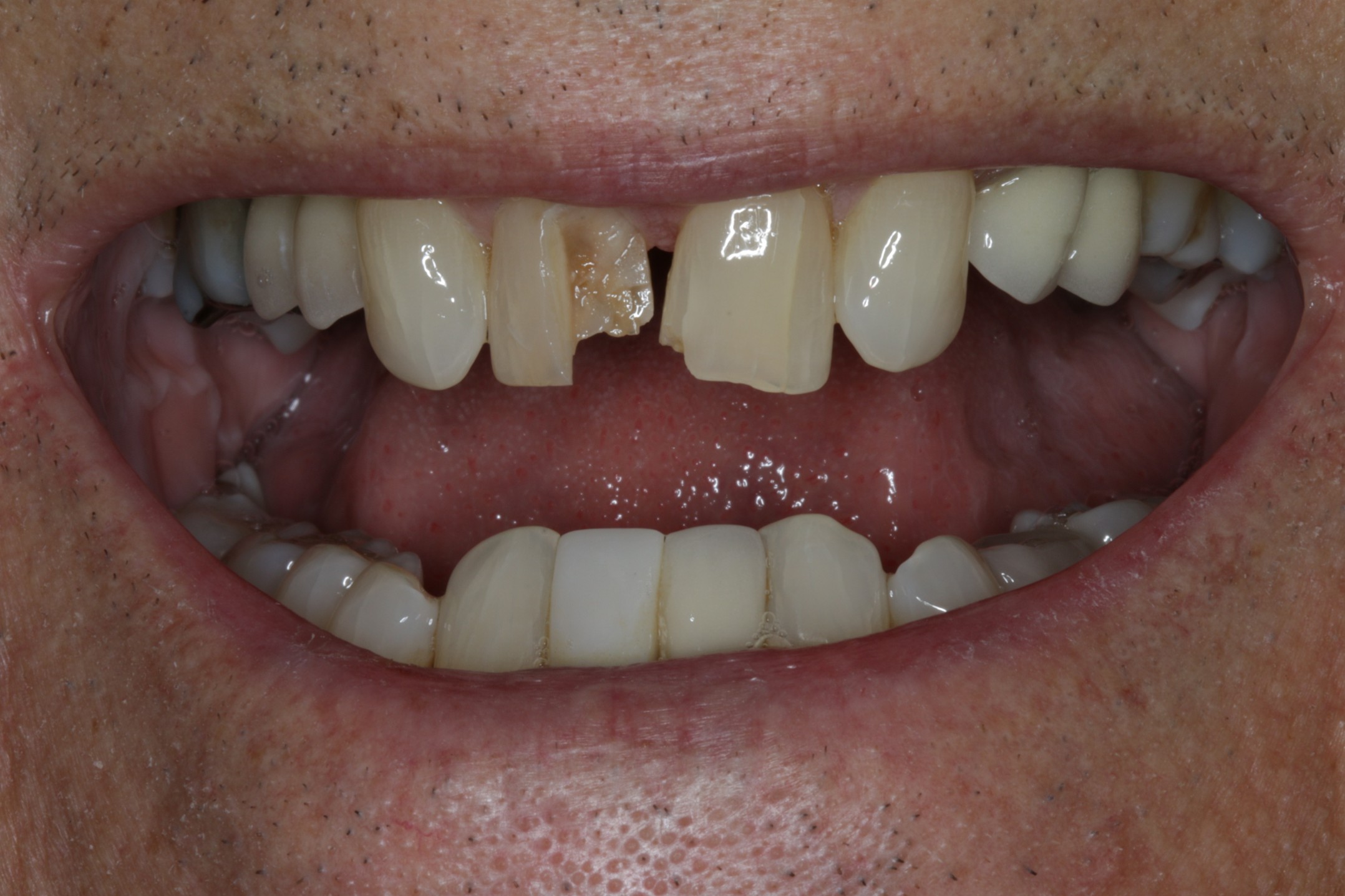 Before Image