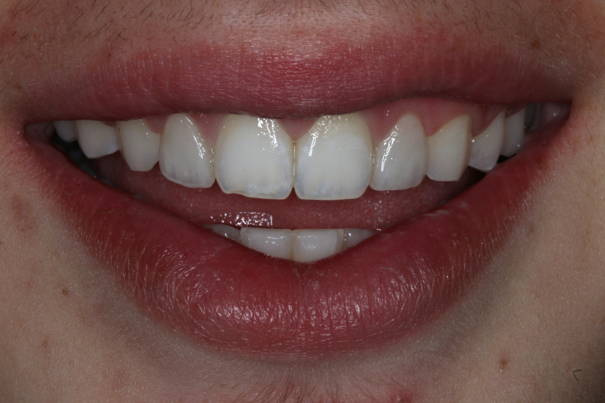 After Image
