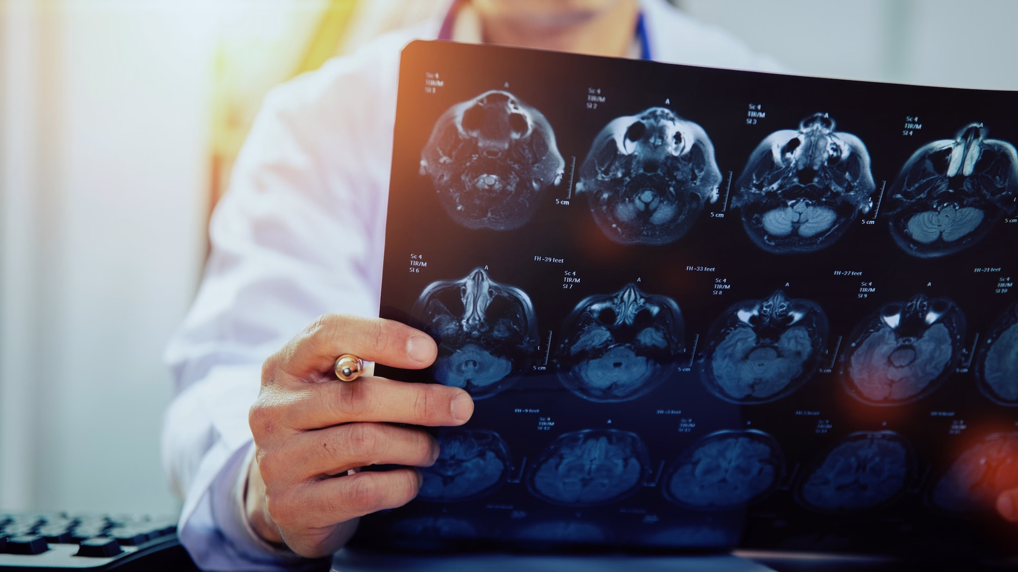 Doctor reviewing a detailed brain scan to diagnose neurological conditions with the best neuroendovascular surgeons in Lancaster, CA, using advanced imaging technology for patient care.