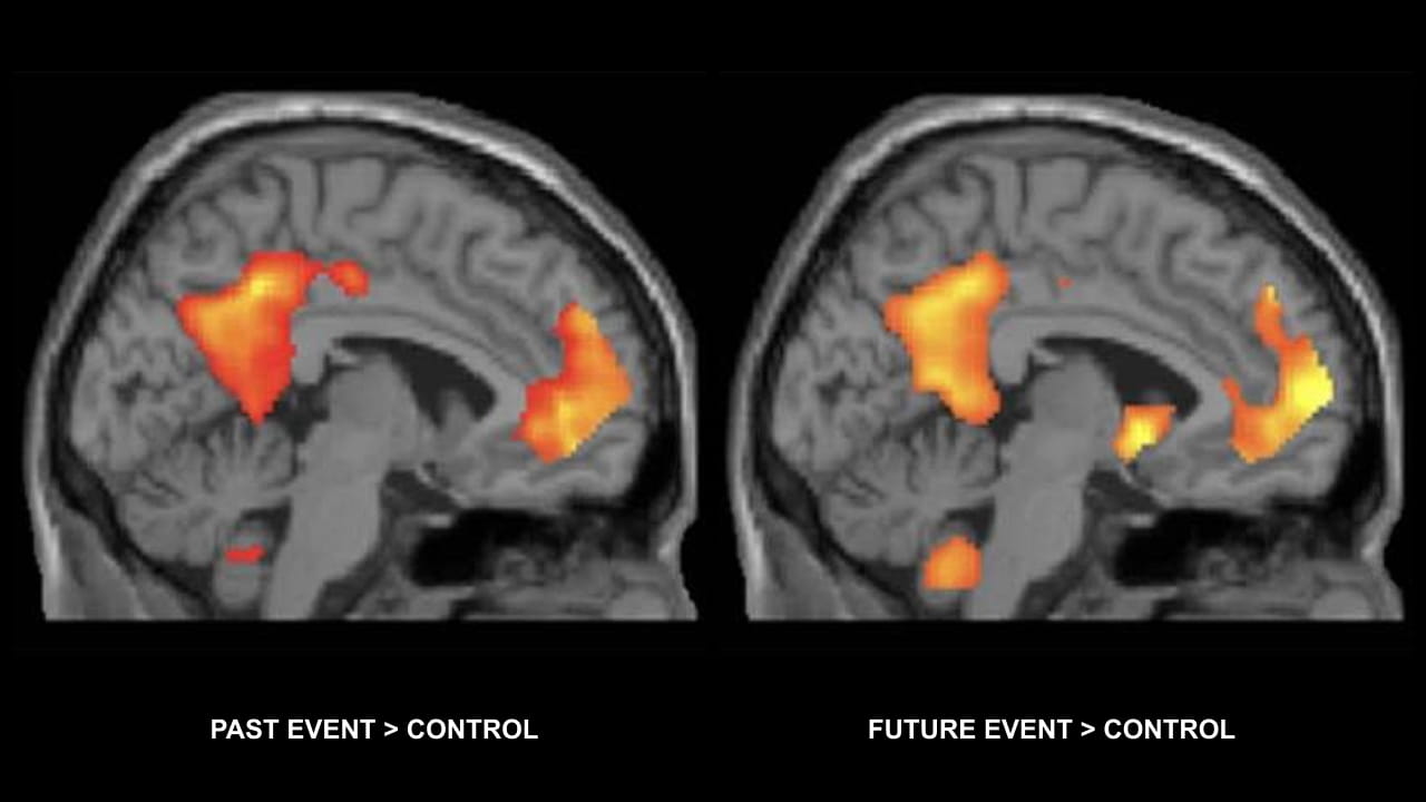 Two brain MRI scans showing highlighted activity areas in orange; left scan labeled 'Past Event > Control' and right scan labeled 'Future Event > Control'. fMRI activation contrasts for past and future event simulation versus control. Orange-red regions indicate significantly greater activation. The near-identical spatial distribution of activity during past memory retrieval (left) and future event construction (right) — including medial prefrontal cortex and posterior cingulate — illustrates the shared neural architecture underlying episodic future thinking (Szpunar, 2010).