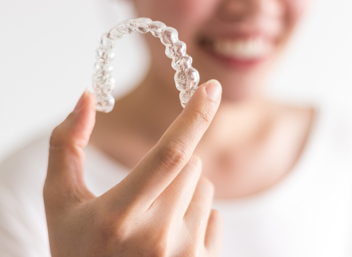 Aligner – transparente Schienensysteme präsentiert in der Hand einer Frau