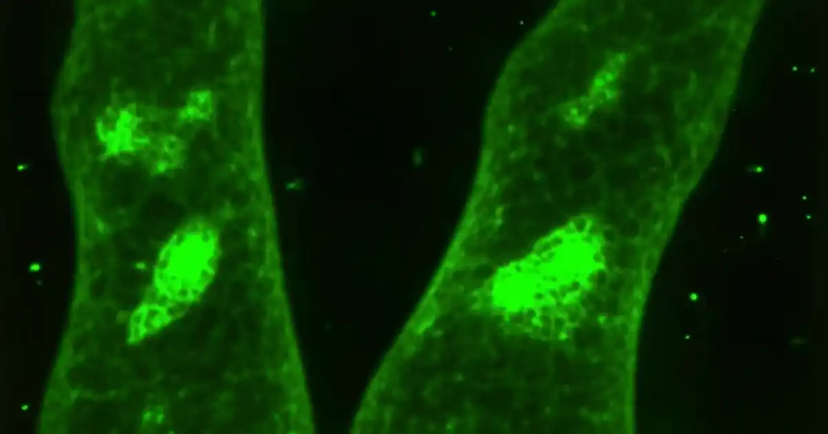 ros mitochondrie photobiomodulation