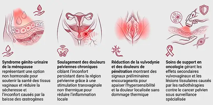 photobiomodulation en gynécologie