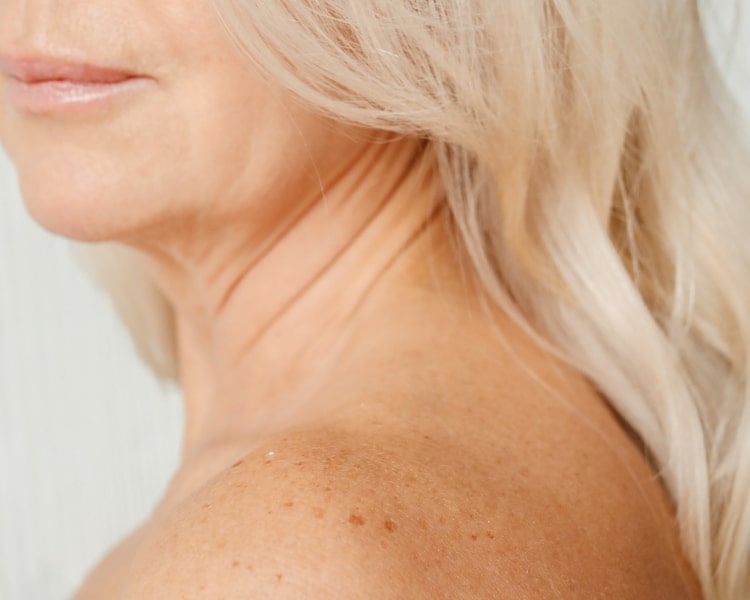 Preventing Loose Skin guidance for SheMed UK weight management programme.