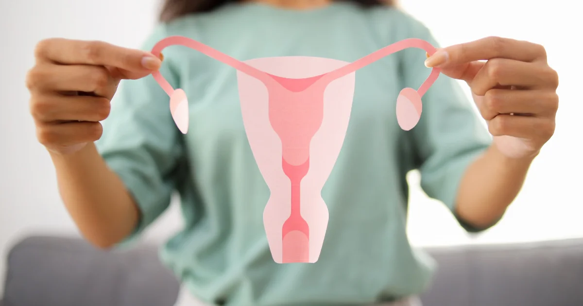 Woman holding a paper illustration of the uterus, ovaries and fallopian tubes in front of her body, representing the female reproductive system affected by PCOS/PMOS
