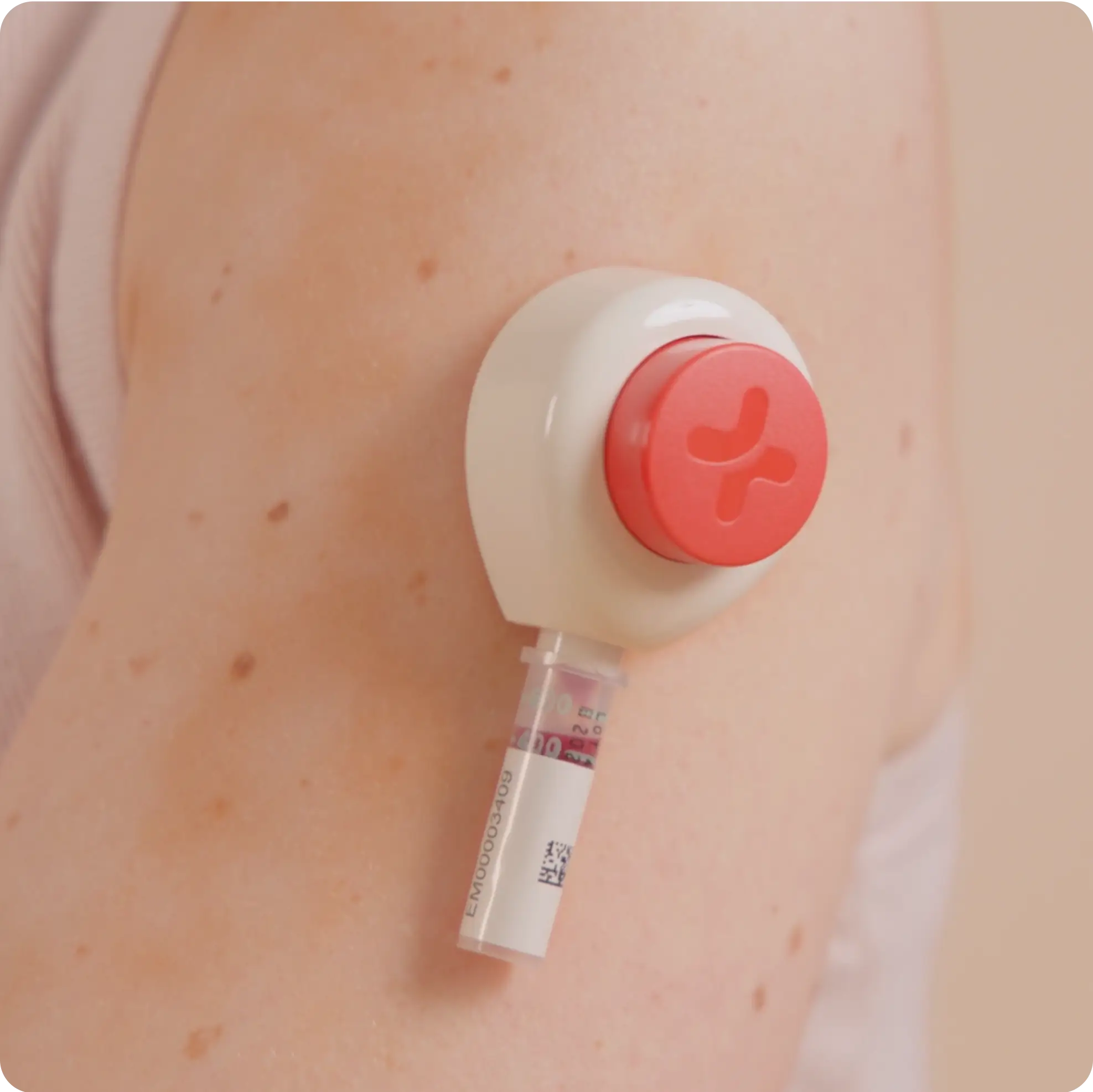 Close-up of a wearable medical device with a red cap attached to a person's upper arm.