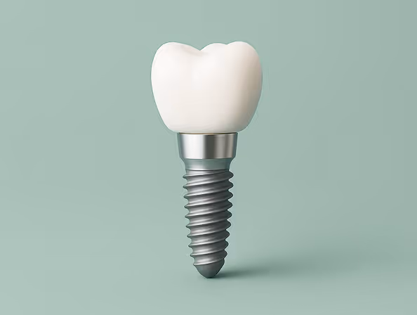 Close-up of a dental implant with a metal screw base and white tooth crown against a light green background.