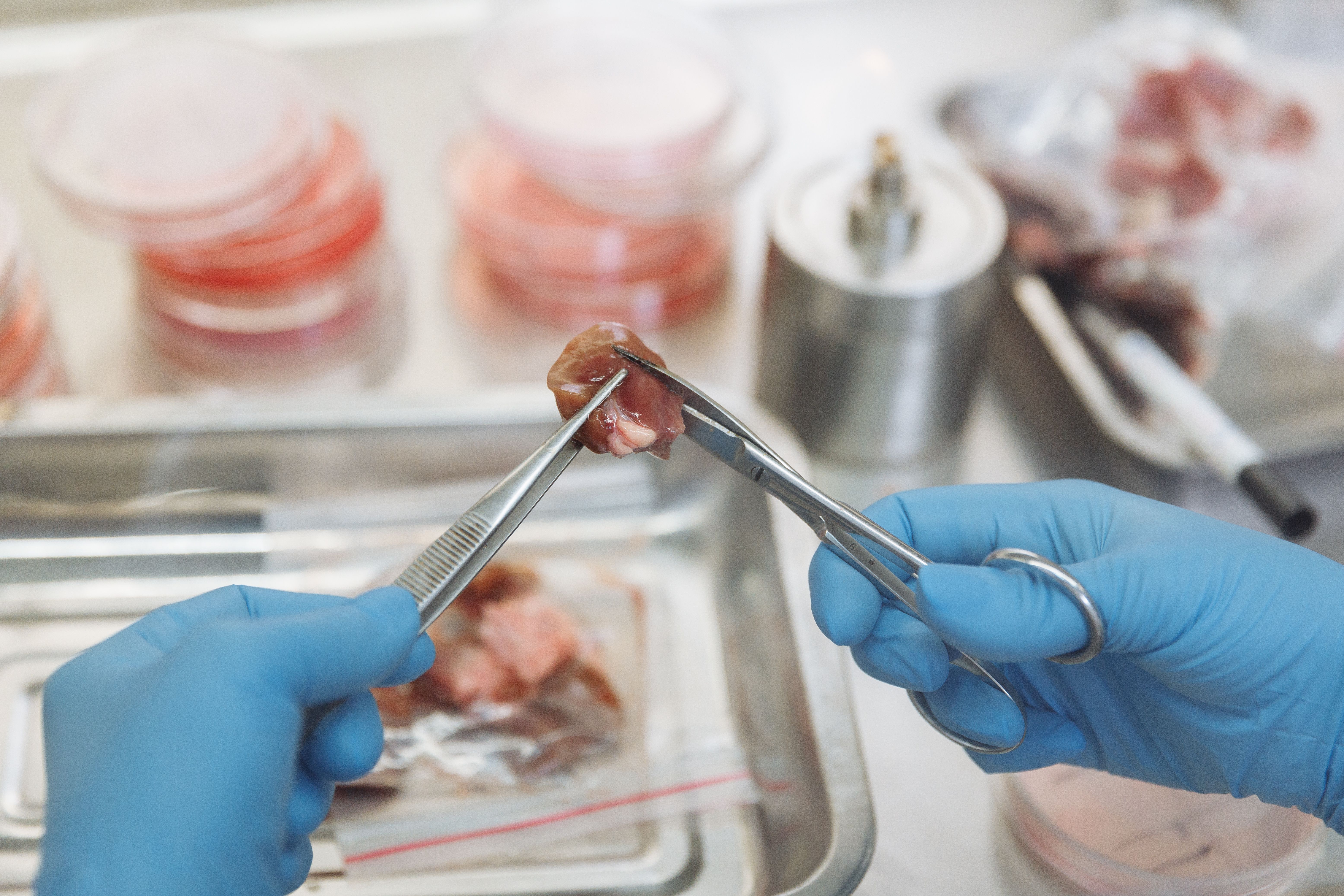 : A technician wearing blue gloves using lab forceps and scissors to inspect a biological sample next to Petri dishes.