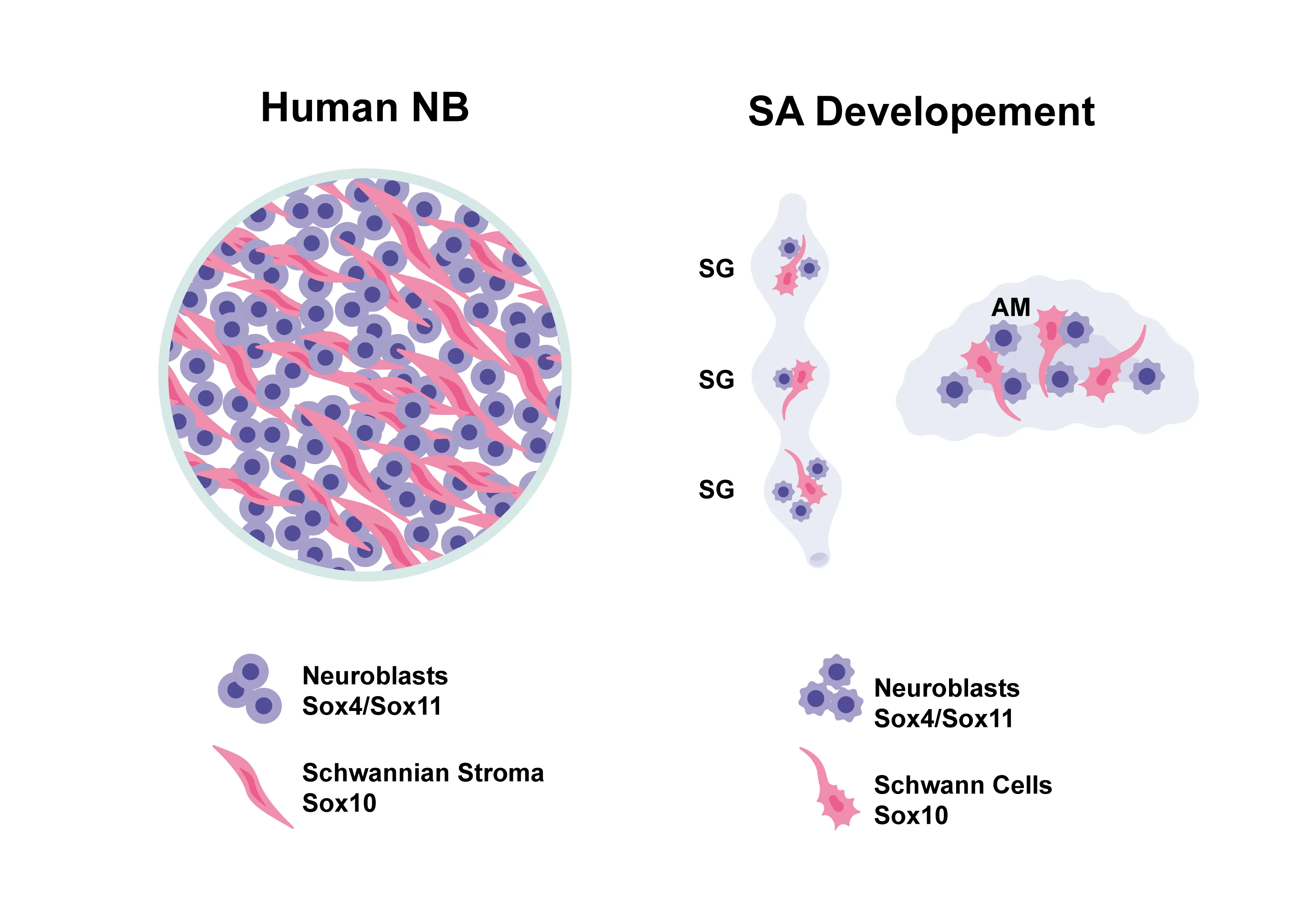 Diagram comparing Human Neuroblastoma (NB) with Schwannian stroma neuroblasts and Sox4/Sox11, and SA Development showing neuroblasts and Schwann cells with their marker proteins Sox4/Sox11 and Sox10.