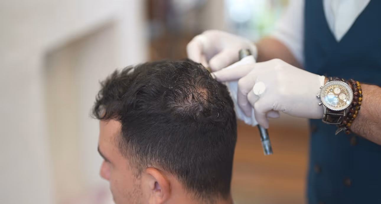 Close up hair restoration in progress