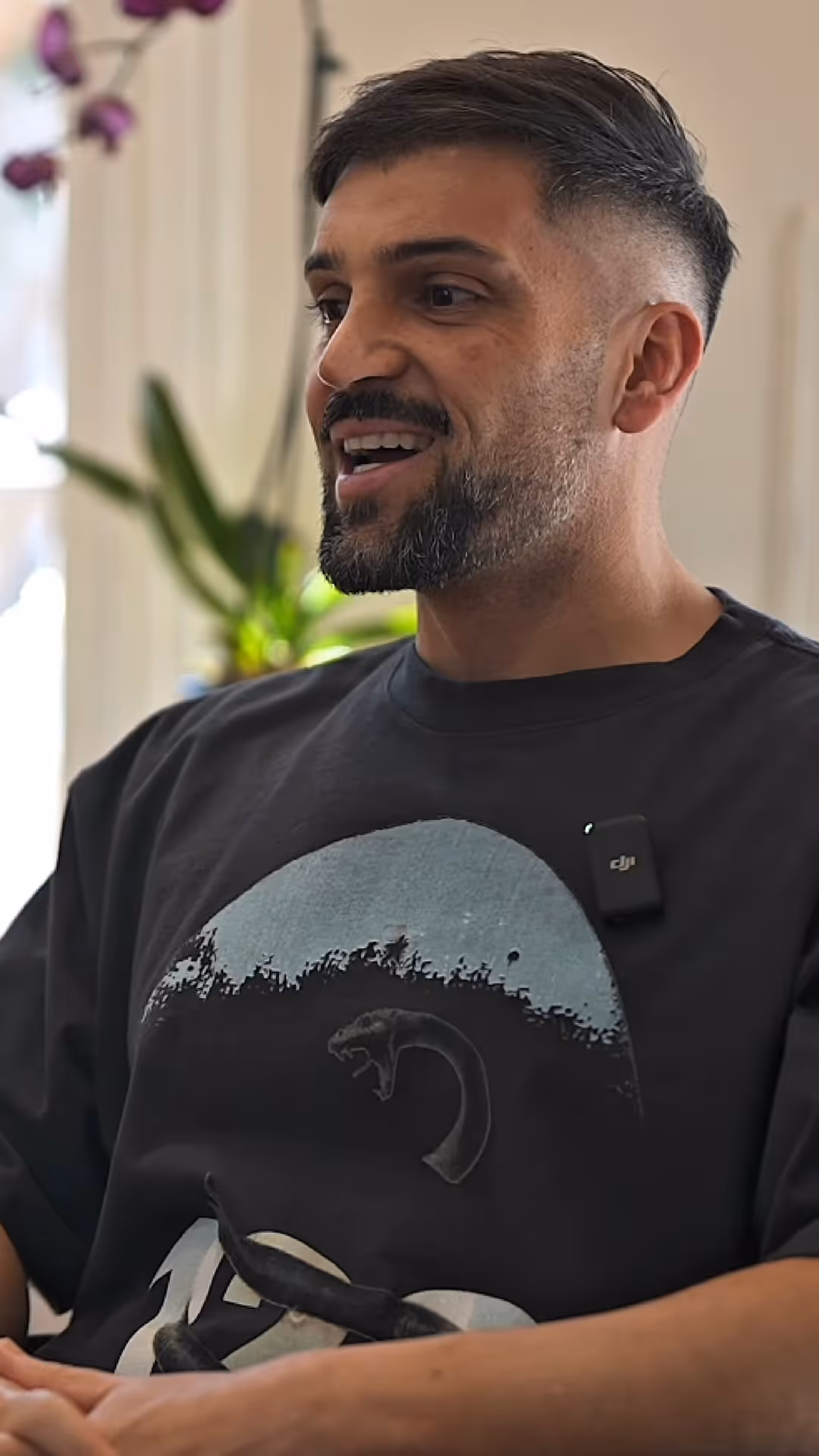 Rich telling hair loss story (play buton over top)