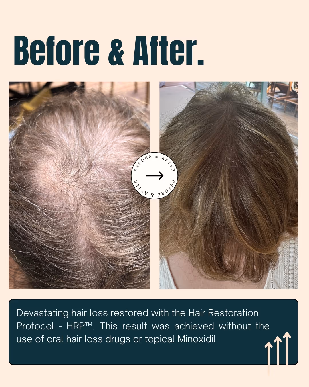 Before and after images from female patients