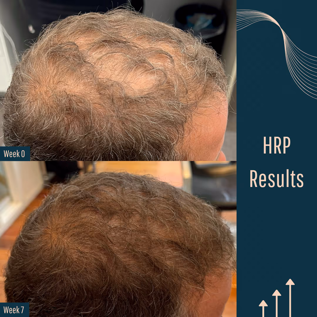 Before and after images from male patients