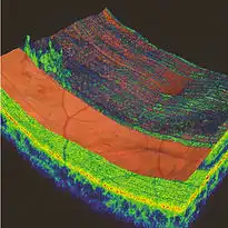Color-enhanced cross-section of retinal layers showing detailed tissue structure in bright colors.