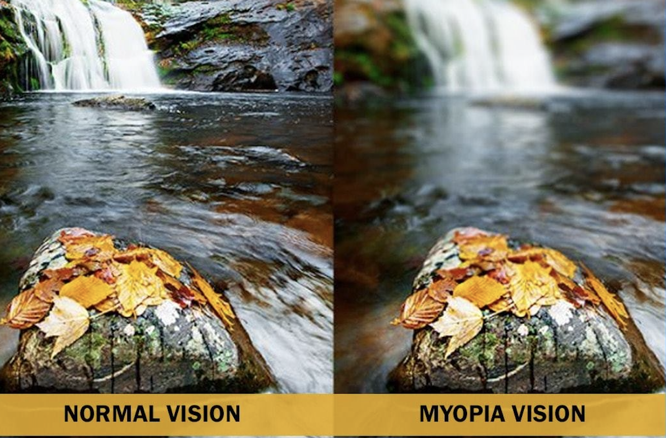 What is Myopia And Why Are We Seeing it Increase in Children?