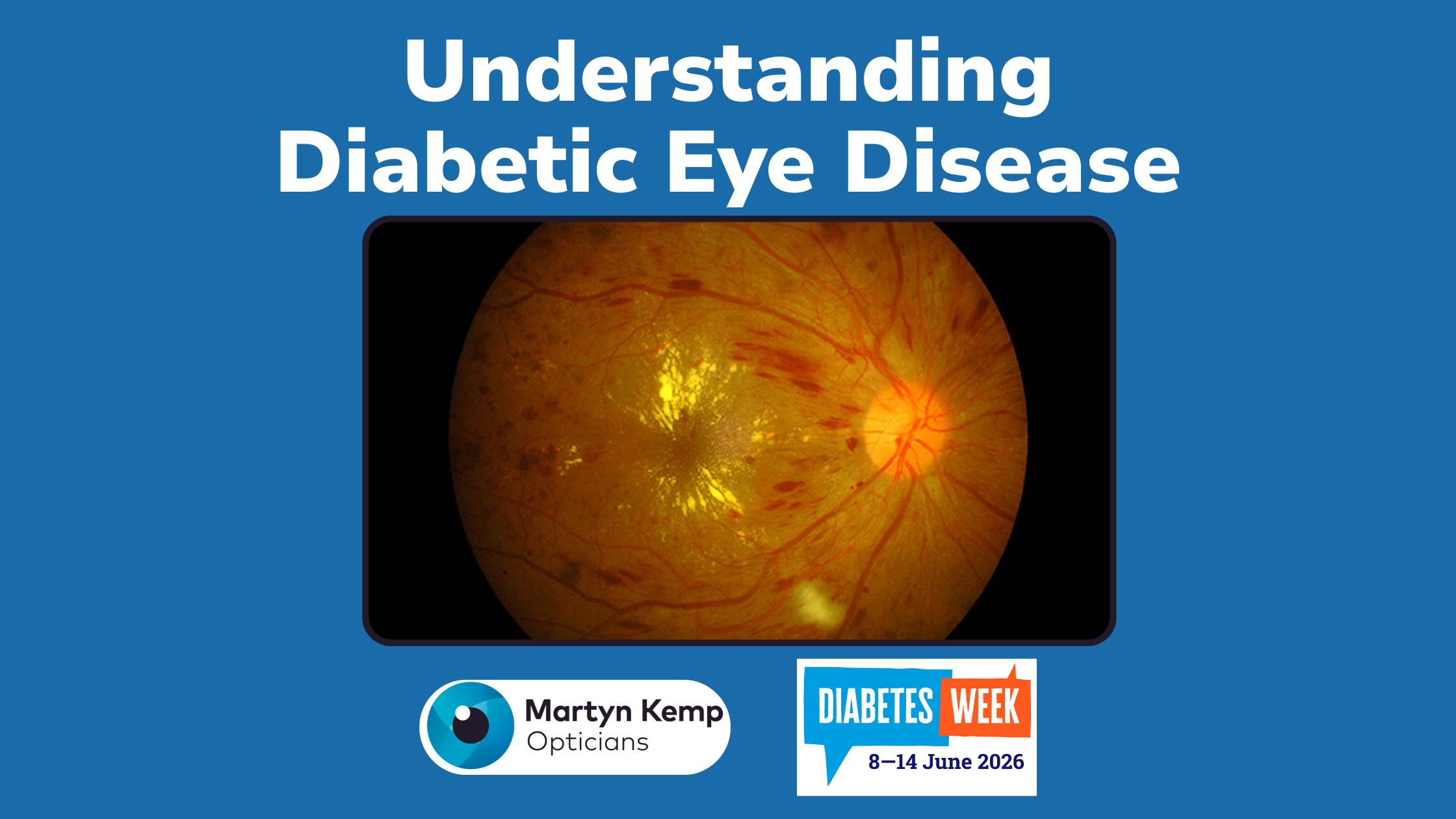 Understanding Diabetic Eye Disease