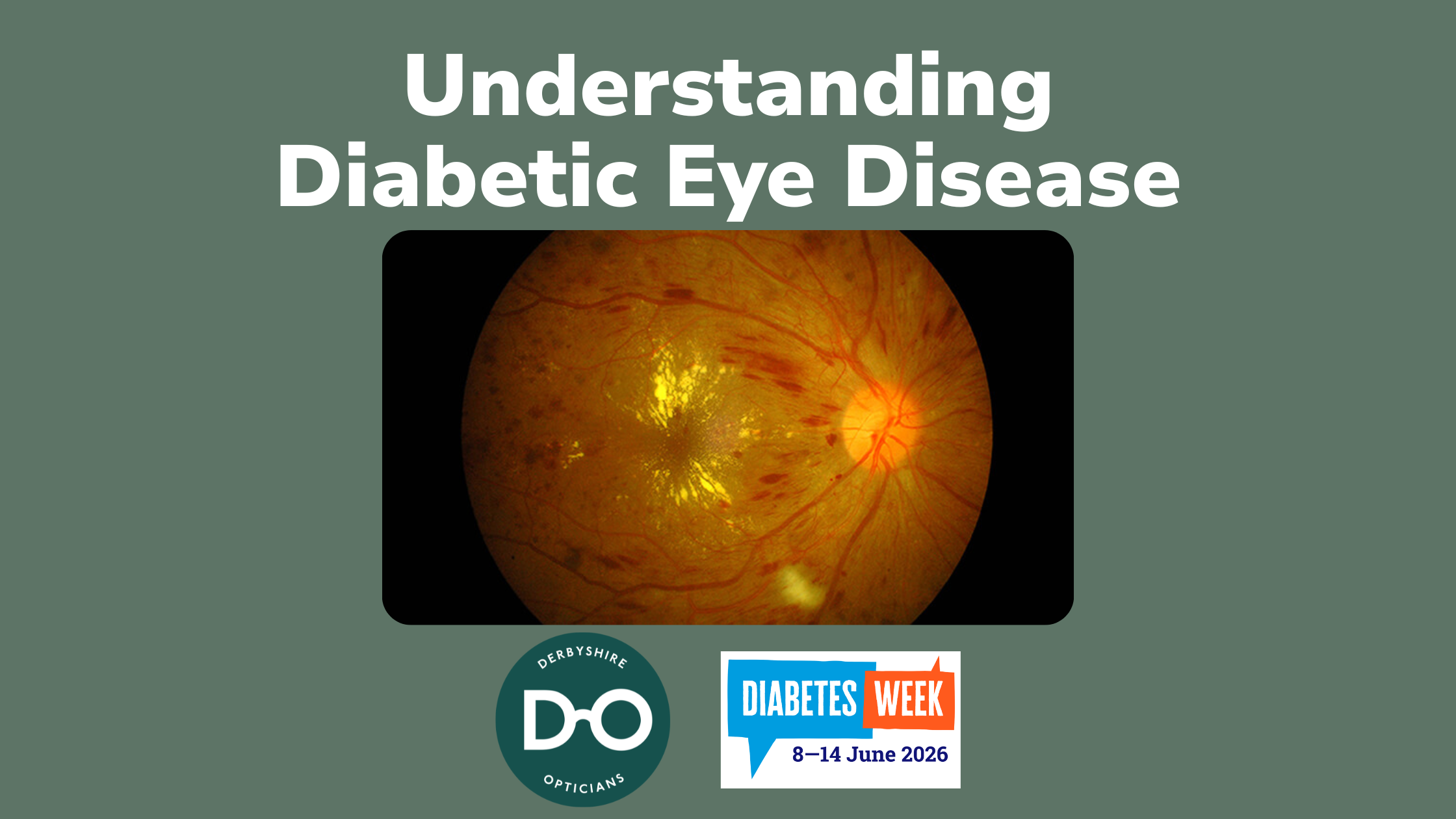 How Diabetes Affects Your Eyes and Vision