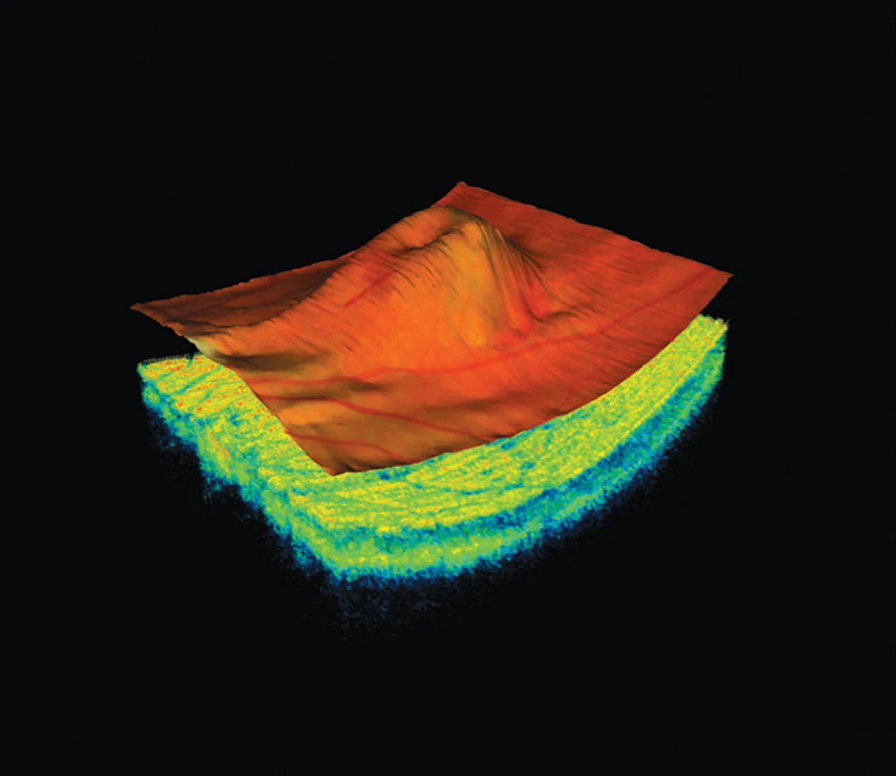3D topographical map with an elevated red and orange peak over a multicolored blue and green base.