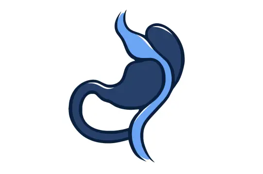 Illustration of gastric bypass surgery showing a small stomach pouch connected to the small intestine, bypassing the larger stomach.