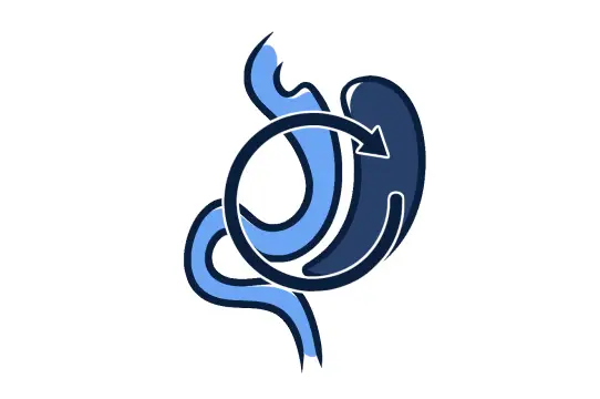 Diagram showing stomach with a circular arrow indicating revision or change.