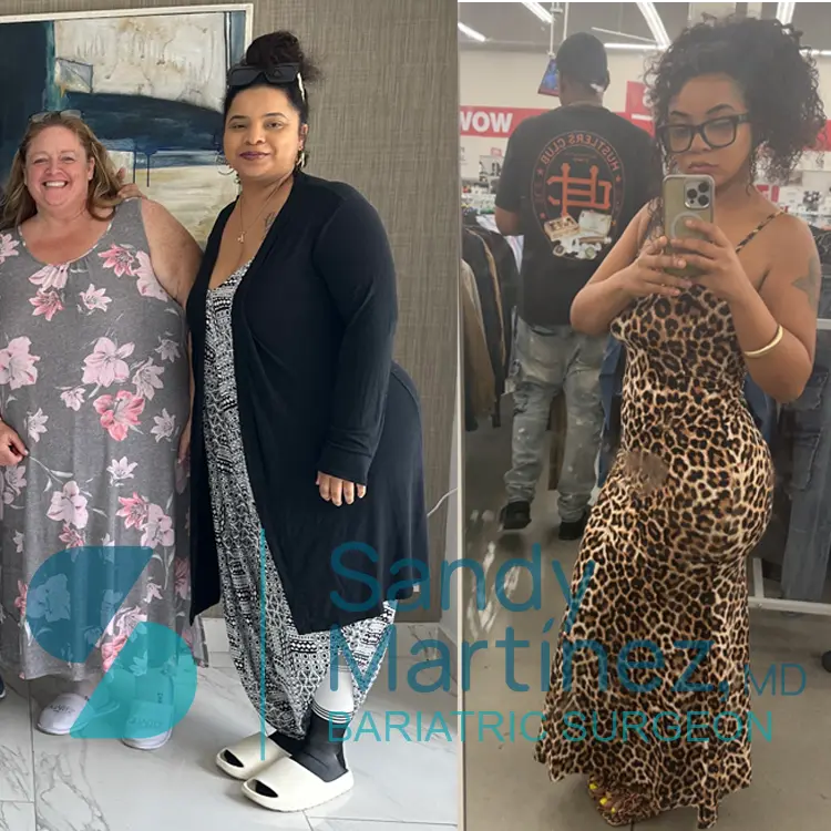 Side-by-side before and after photos of a woman showing significant weight loss; the left photo shows her with another woman indoors, the right photo is a mirror selfie of her in a leopard print dress.