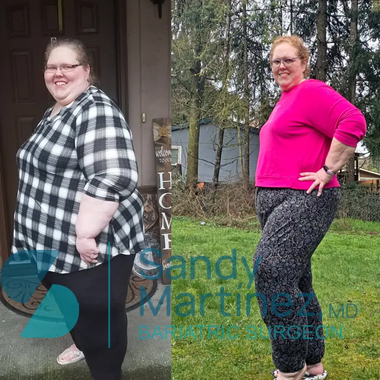 Side-by-side photo showing a woman before and after weight loss, smiling and posing outdoors and near a door.