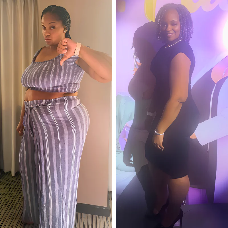 Dr. Sandy Bariatrics - Before and After Gastric Sleeve Photo