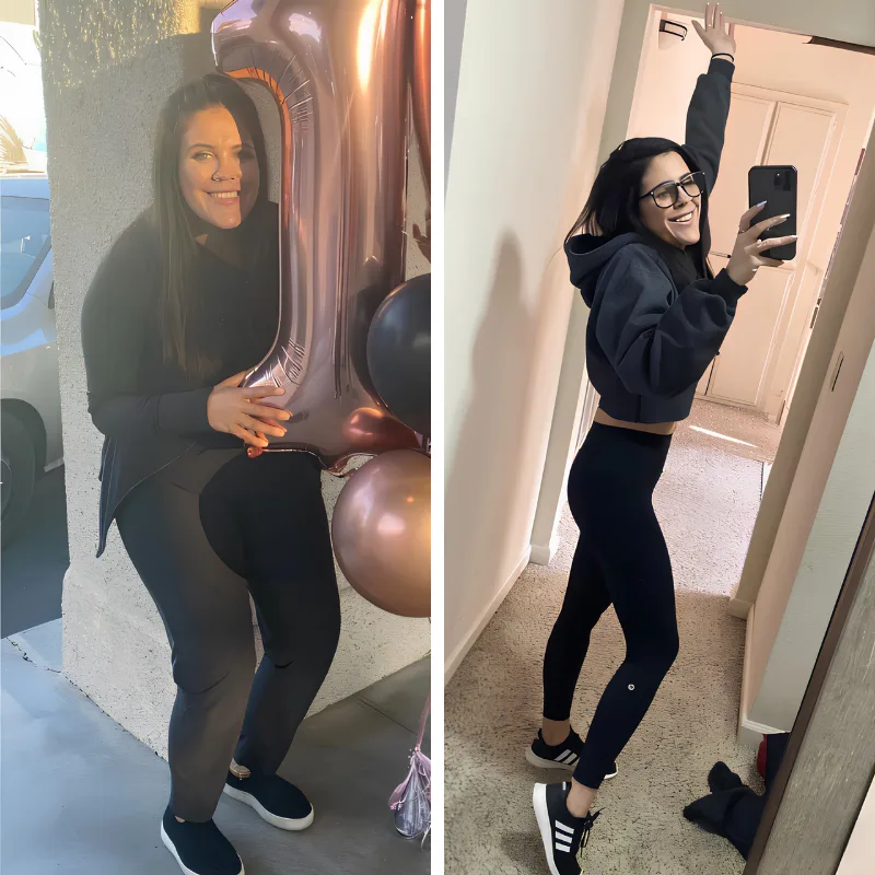 Gastric Sleeve Before and After - Dr. Sandy Bariatrics