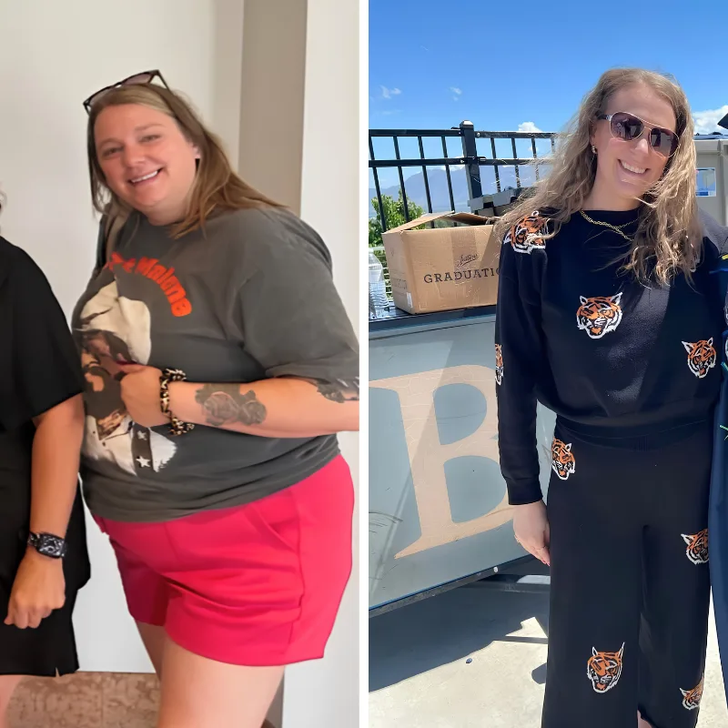 Gastric Bypass Weight Loss Before and After 100lbs Down