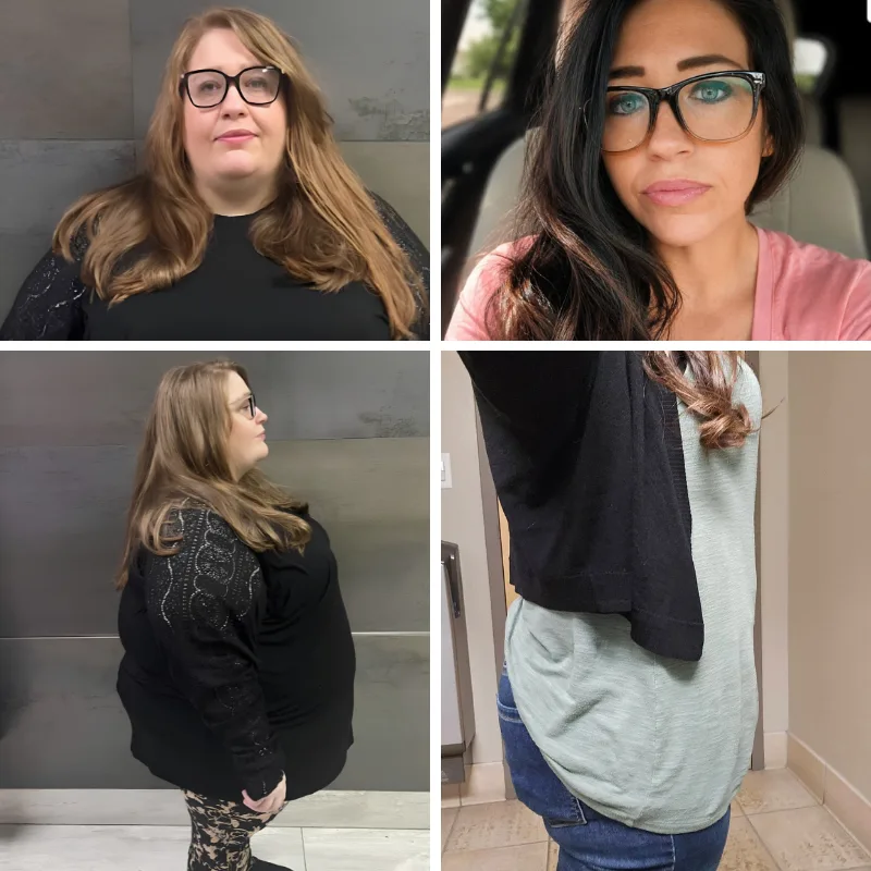 Duodenal Switch (SADi-S) Before and After Photo - Kimberly Hawkins