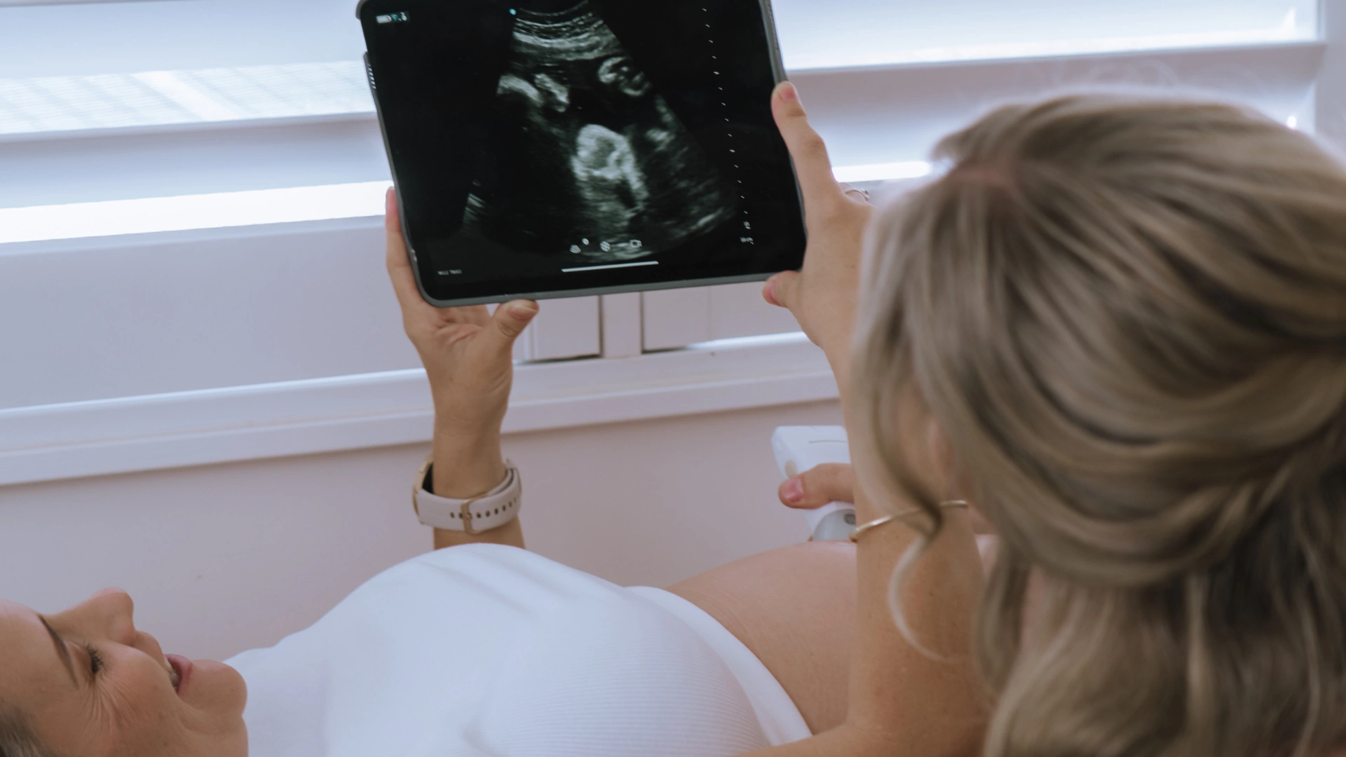 Photo of a woman lying and a midwife looking at an obstetric ultrasound on a screen