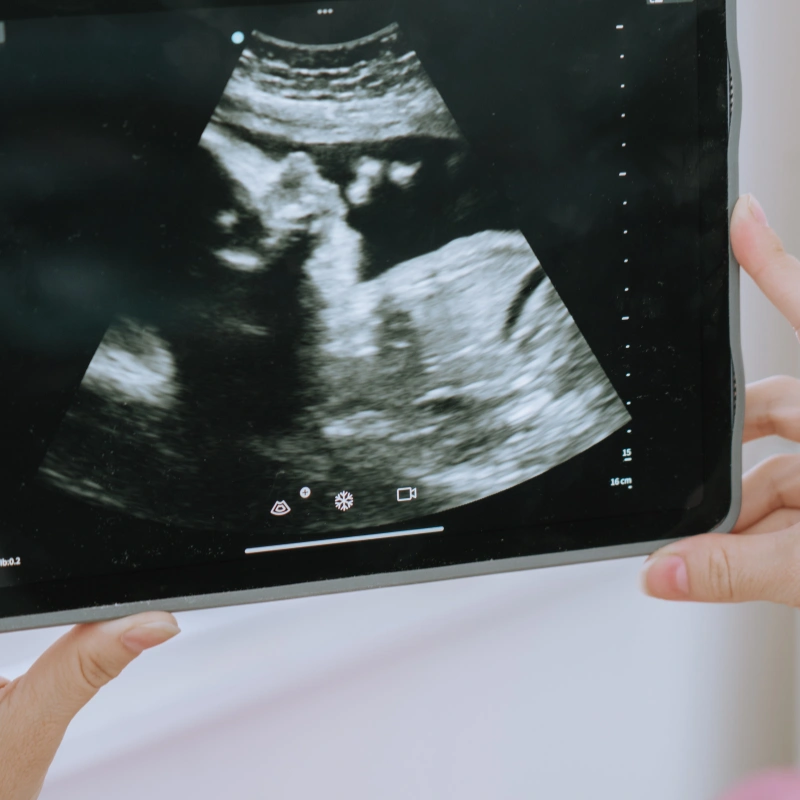 Close-up photo of a pregnant person holding a tablet showing an ultrasound image of their baby during a prenatal visit