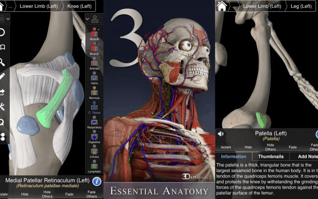 3D4Medical