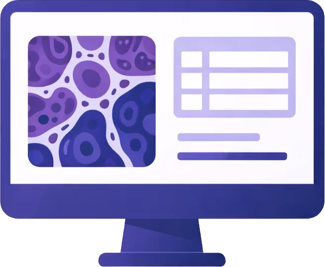 Illustration of a computer monitor displaying a histopathology image  on the left and clinical reporting concept on the right.