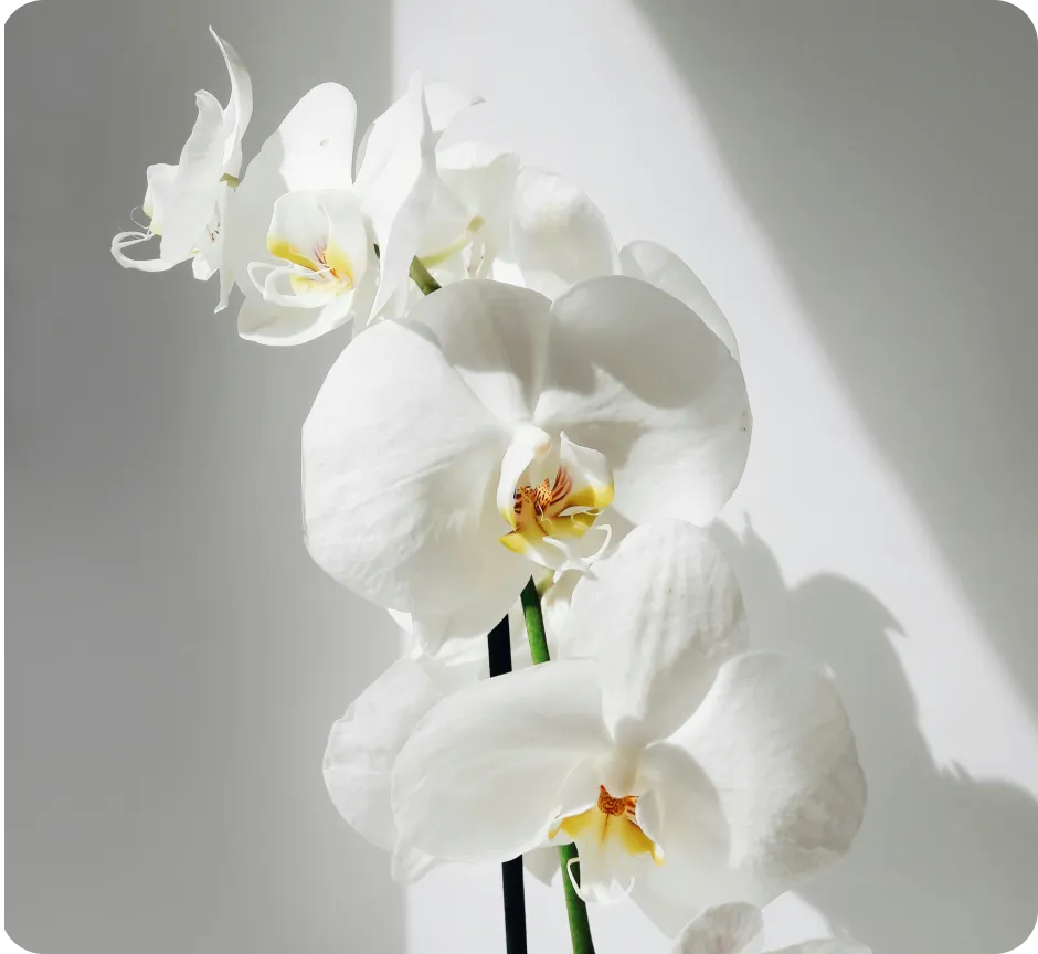 Close-up of white orchid flowers with yellow and brown centers against a light gray background.