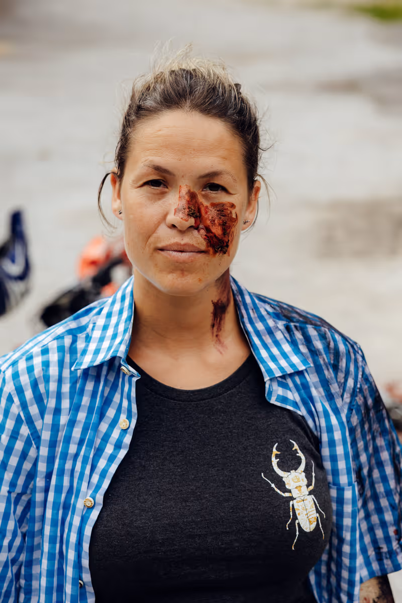 Frau mit blauen Karoshirt und schwarzem T-Shirt mit Käfermotiv, mit Schürfwunde im Gesicht und am Hals.