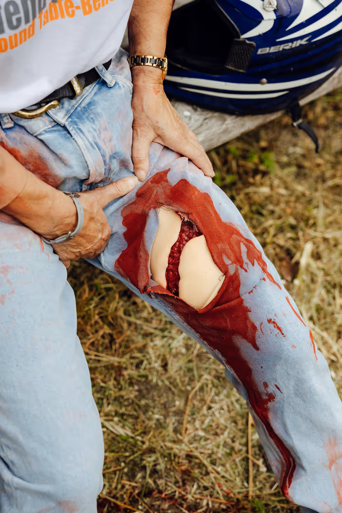 Person mit stark blutiger, aufgerissener Jeans am Bein und Helm neben sich.