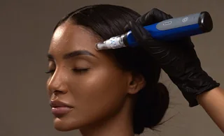 SkinPen microneedling treatment