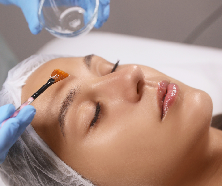 Medical grade chemical peel treatment at Elite Skin and Body MD Spring TX