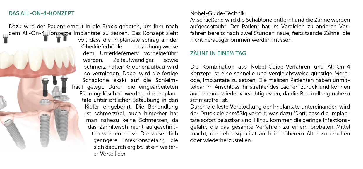 Zahnarzt Flyer All on 4 – feinedesign