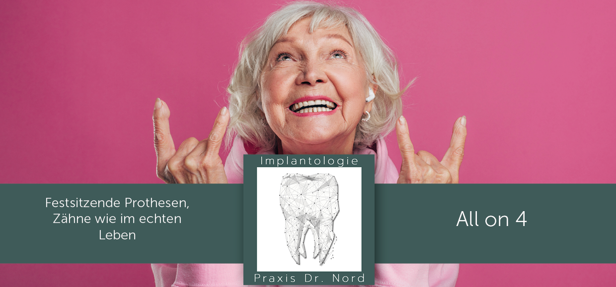 Zahnarzt Flyer All on 4 – feinedesign