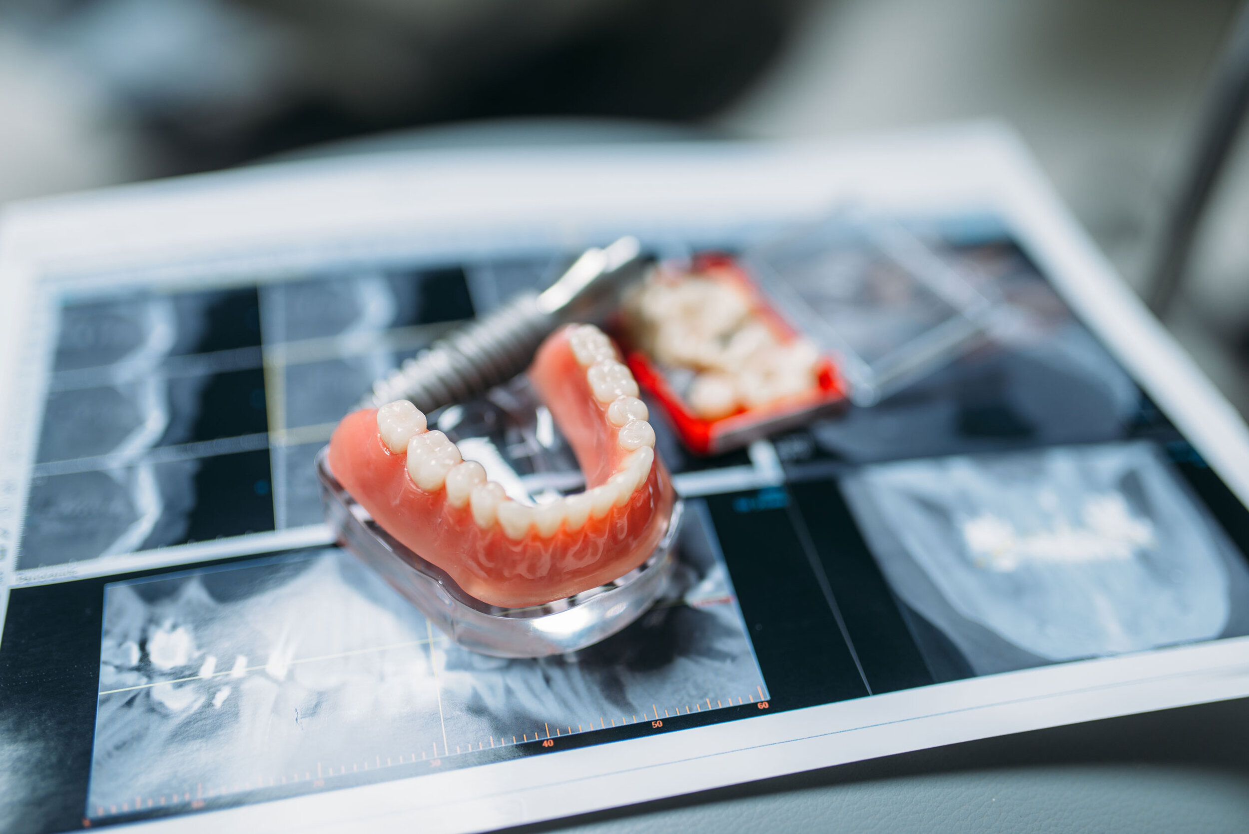 Model of dental dentures placed on dental X-ray images.