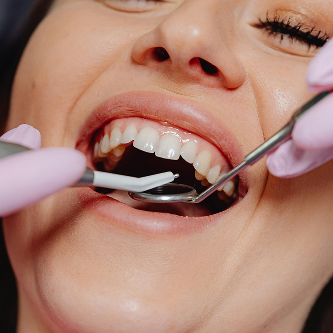 Close-up of a smiling woman's mouth with dental tools in use during a checkup.